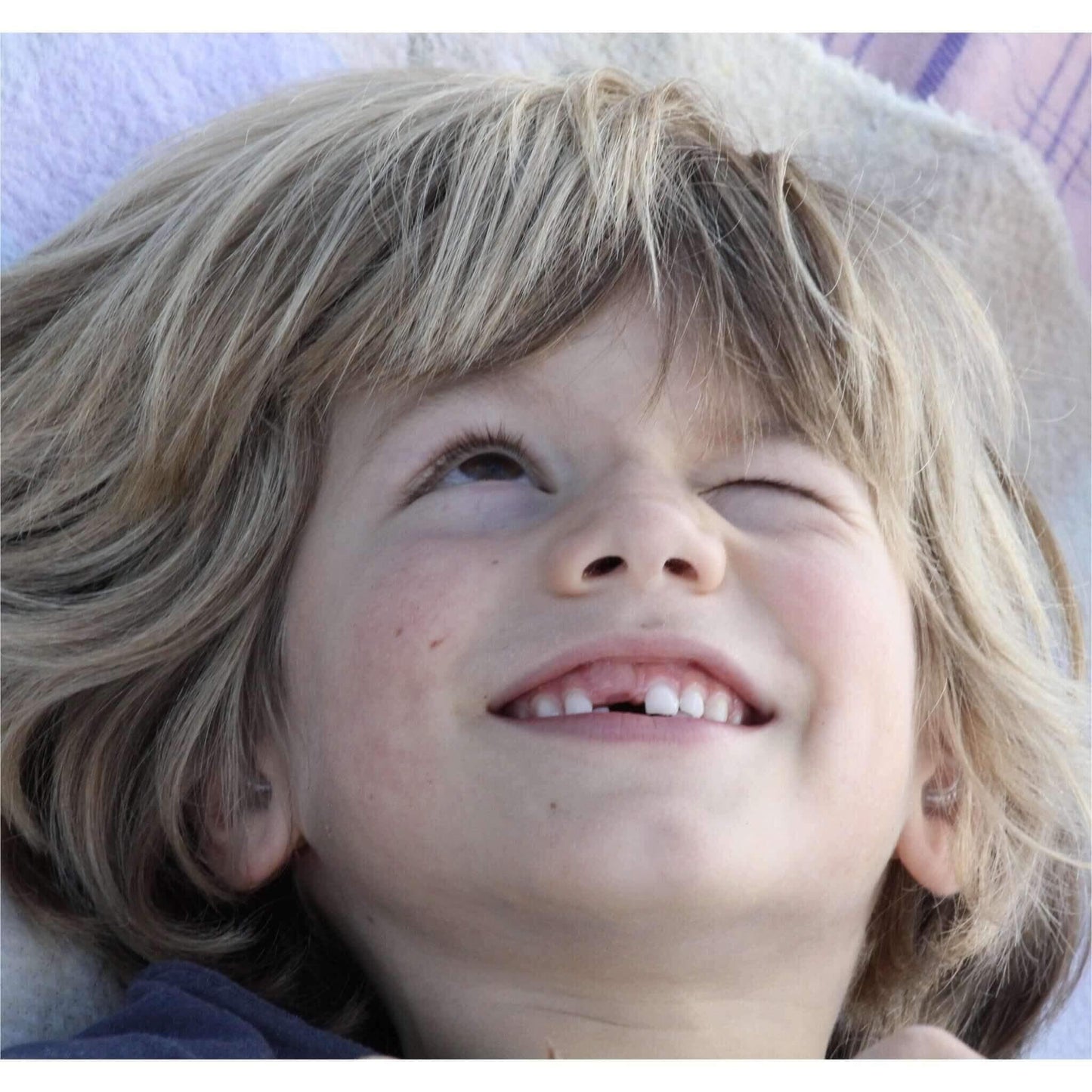 young boy with sensitive skin laughing